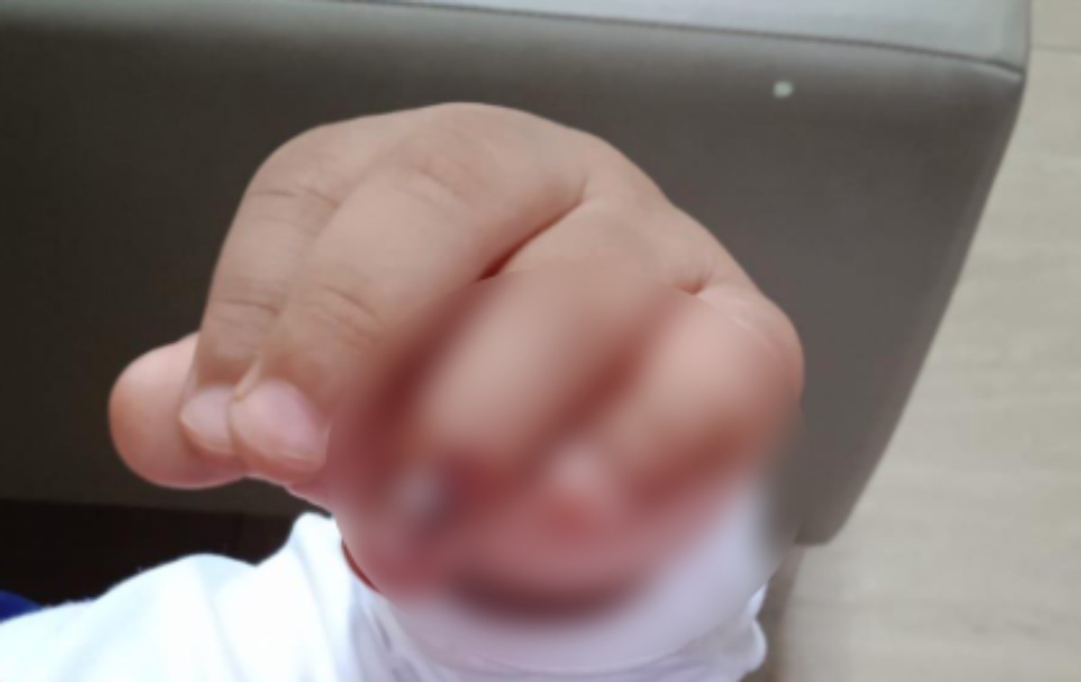 Bebê prende mão em brinquedo de parquinho público de Londrina, e fundação é condenada a pagar indenização à família