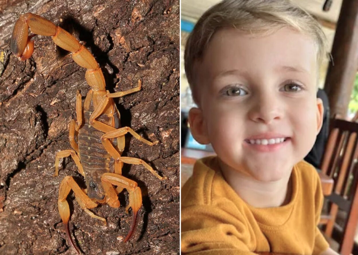 Menino morto por picada de escorpião recebeu soro antiveneno mais de 4 horas após acidente; polícia investiga negligência