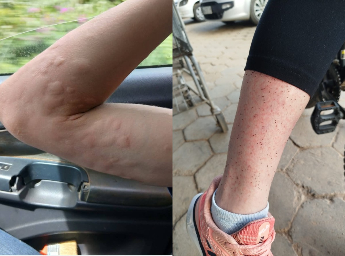 De enchente a plantações: o que explica infestação de mosquito que fez moradores em SC se 'trancarem' em casa?