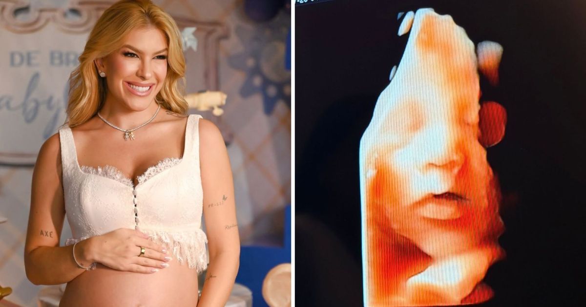Lore Improta mostra rostinho do filho em ultrassom: “A cara do papai”
