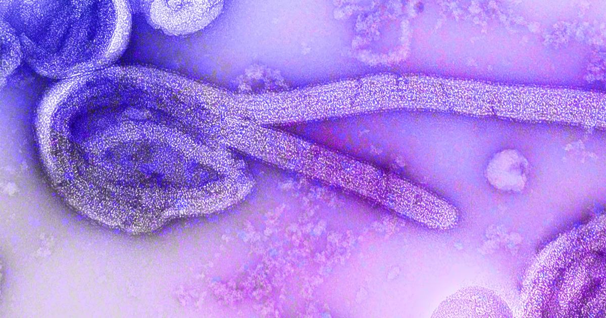 Paciente de Uganda sob suspeita de Ebola testa positivo para malária no RJ