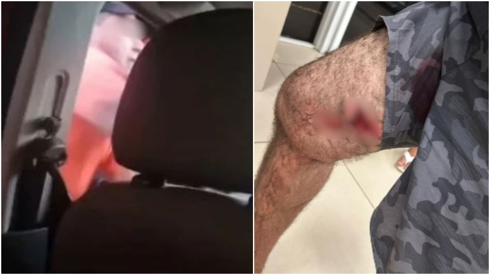 Policial é solto após confusão em que foi baleado e deixou homem ferido na Grande Fortaleza