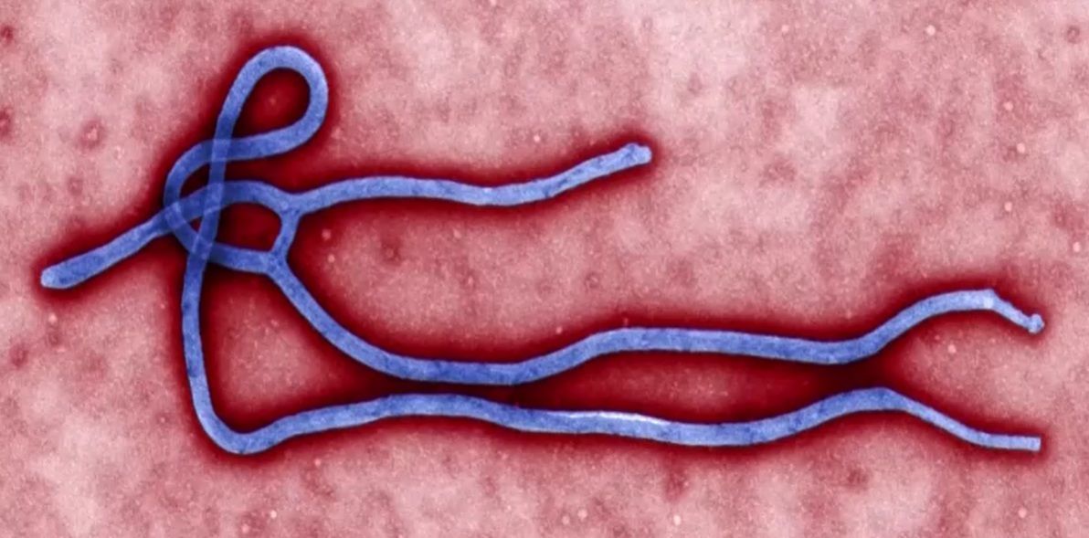 Dimensão do surto de Ebola no Congo segue desconhecida