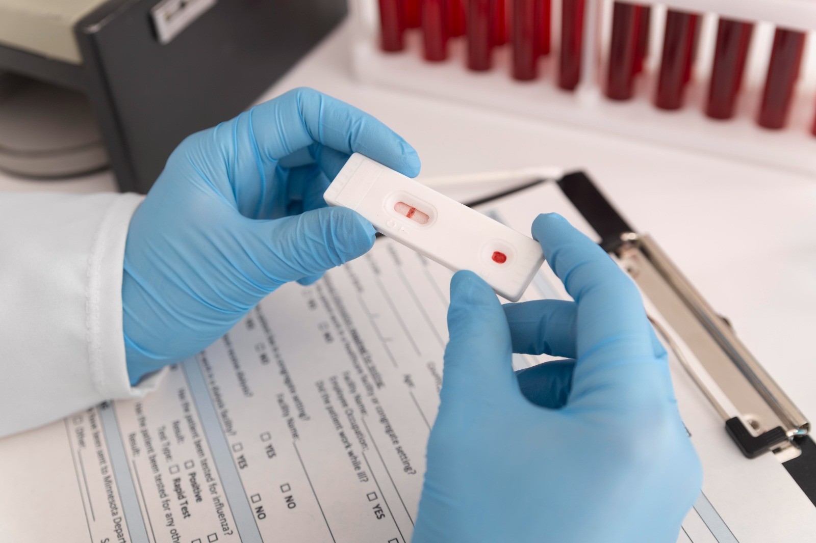 Julho Amarelo oferece testagem gratuita para hepatites, HIV e sífilis em Belém