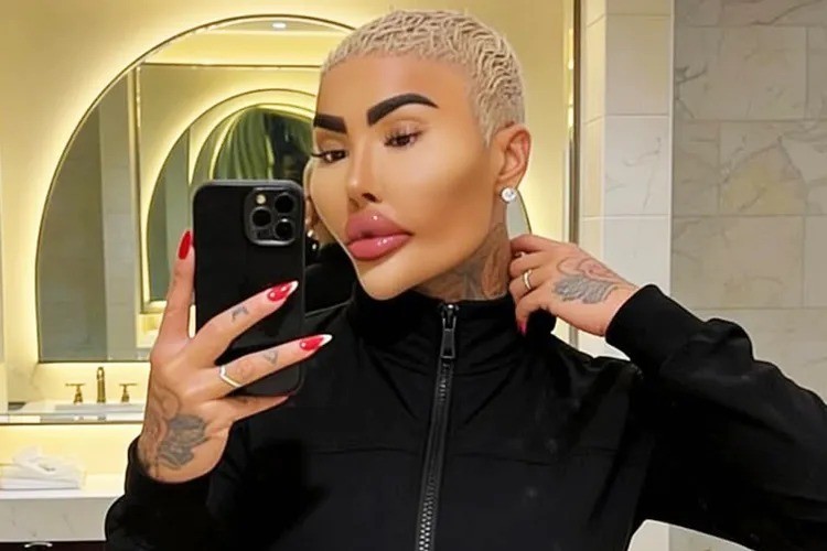 Influenciador e “Rei dos Lábios” Jordan James Parke morre após possível procedimento estético