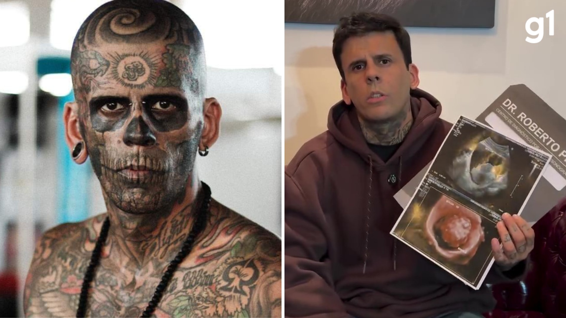 'Mais tatuado do Brasil' conta que fará tratamento contra câncer pelo SUS