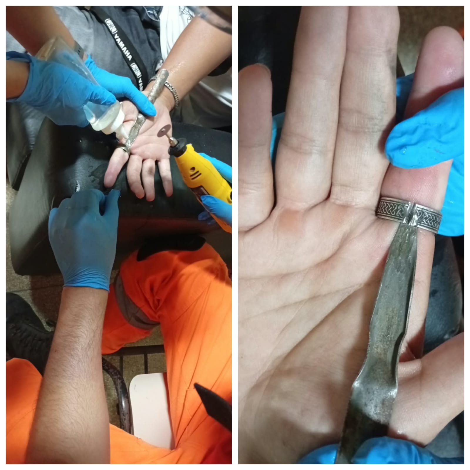 Jovem busca ajuda dos bombeiros após ficar com anel preso no dedo em Januária