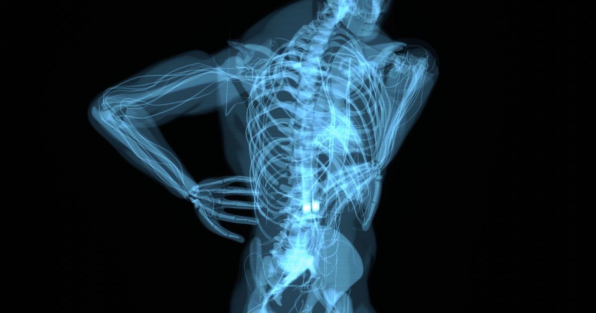 Uso da polilaminina: cientista admite erros em estudo, mas garante eficácia